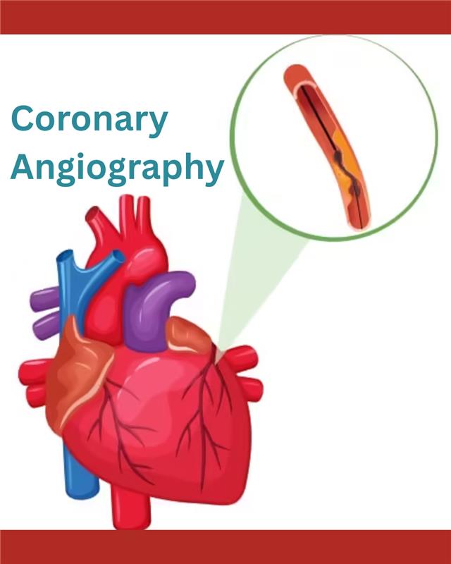 A Patient’s Guide to Coronary Angiography